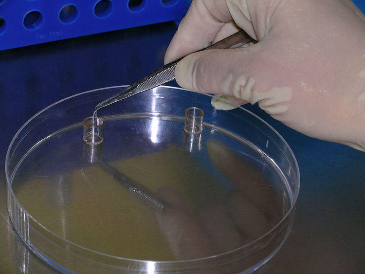 Dodatkowe pieniądze na miejski program in vitro w Łodzi 1 29466 3e9cc63ccee786c81f8fba9720f34951