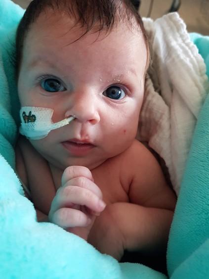 Specjalistyczna aparatura ECMO ratuje kolejne noworodki 1 52292 a1e0937d3e879a6585514a9d1c11c738