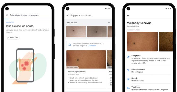 Wirtualny dermatolog | Login 1 71765 1c4d67a76d49288f9016e7925d3f7def