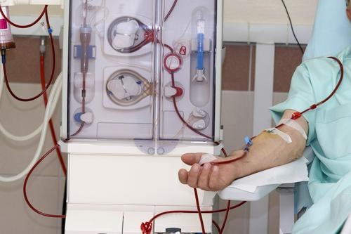 Stacja dializ w Zgierzu. Dobro pacjenta a walka o miliony z NFZ... 1 Stacja dializ