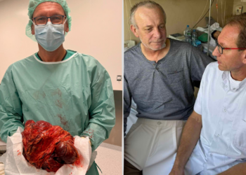 Brawurowa operacja zakończona sukcesem. W sieradzkim szpitalu wycięto pacjentowi gigantycznego guza