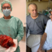 Brawurowa operacja zakończona sukcesem. W sieradzkim szpitalu wycięto pacjentowi gigantycznego guza 6 Brawurowa operacja zakończona sukcesem. W sieradzkim szpitalu wycięto pacjentowi gigantycznego guza