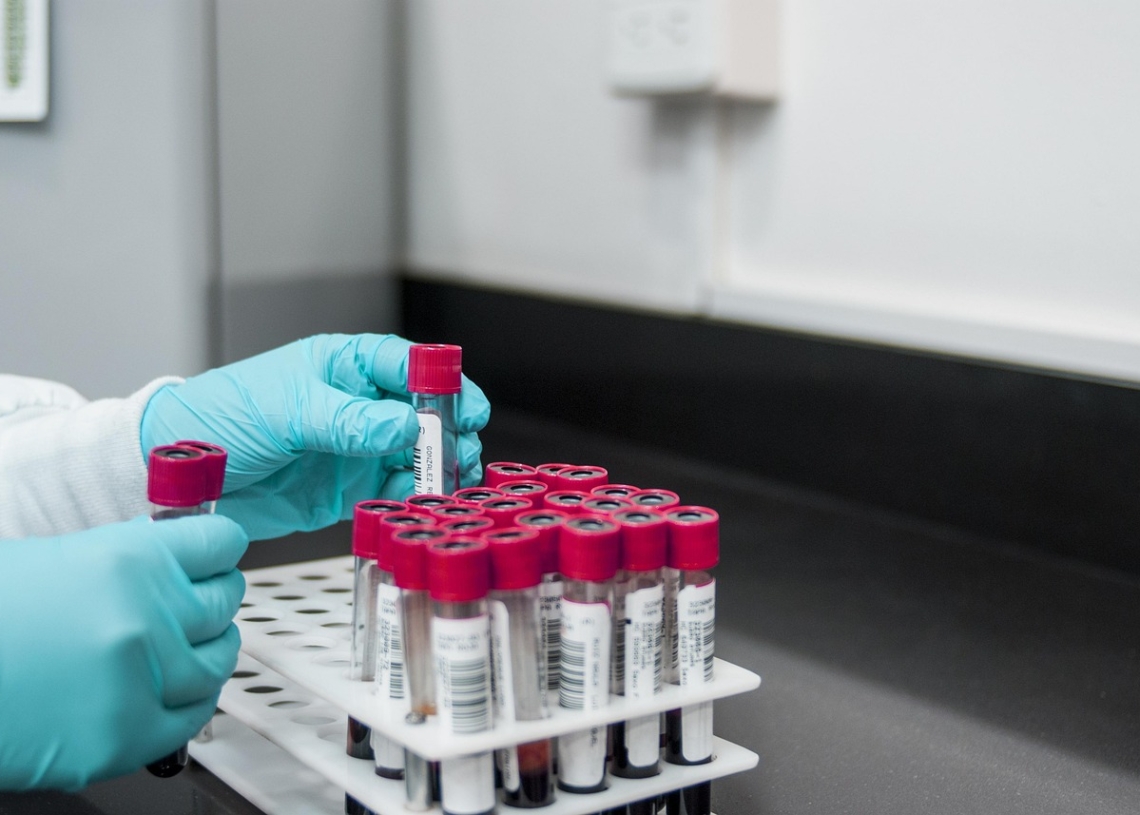 NFZ zachęca kobiety do bezpłatnych testów na obecność HPV 1 NFZ zachęca kobiety do bezpłatnych testów na obecność HPV