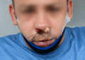 Brutalne pobicie w Łodzi. Napastnik miał wziąć mężczyznę za obywatela Ukrainy 3 IMG 9268